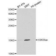 Western blot analysis of extracts of various cell lines, using Acetyl-Histone H3-K56 antibody (abx123386) at 1/1000 dilution.
