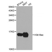 Western blot analysis of extracts of various cell lines, using Acetyl-Histone H3-K18 antibody (abx123387) at 1/1000 dilution.