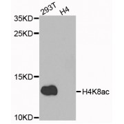 Western blot analysis of extracts of various cell lines, using Acetyl-Histone H4-K8 antibody (abx123388) at 1/1000 dilution.