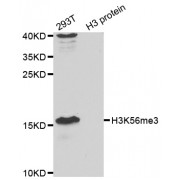 Western blot analysis of extracts of various cell lines, using Trimethyl-Histone H3-K56 antibody (abx123389) at 1/1000 dilution.