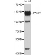 Western blot analysis of extracts of Jurkat cells, using PARP1 antibody (abx123435) at 1/1000 dilution.