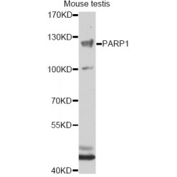Poly ADP Ribose Polymerase (PARP) Antibody