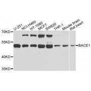 Western blot analysis of extracts of various cell lines, using BACE1 antibody (abx123457) at 1/1000 dilution.