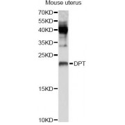 Western blot analysis of extracts of mouse uterus, using DPT Antibody (abx123538) at 1/1000 dilution.