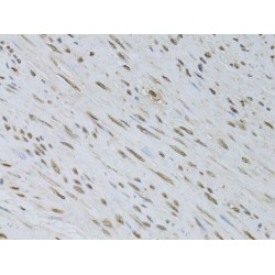 Hepatoma Derived Growth Factor-Related Protein 3 (HDGFRP3) Antibody