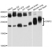 Western blot analysis of extracts of various cell lines, using CRIP2 Antibody (abx123545) at 1/1000 dilution.
