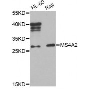 Western blot analysis of extracts of various cell lines, using MS4A2 Antibody (abx123574) at 1/1000 dilution.