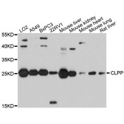 Western blot analysis of extracts of various cell lines, using CLPP antibody (abx123603) at 1/1000 dilution.