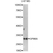 Western blot analysis of extracts of U-87MG cells, using GPM6A antibody (abx123605) at 1/1000 dilution.