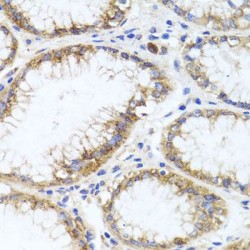 Neuronal Membrane Glycoprotein M6-A (GPM6A) Antibody