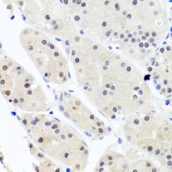 Heterogeneous Nuclear Ribonucleoprotein C-Like 1 (HNRNPCL1) Antibody