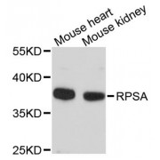Western blot analysis of extracts of various cell lines, using RPSA antibody (abx123633) at 1:3000 dilution.