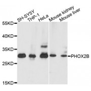 Western blot analysis of extracts of various cell lines, using PHOX2B antibody (abx123655) at 1/1000 dilution.