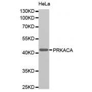 Western blot analysis of extracts of HeLa cells, using PRKACA antibody (abx123703).