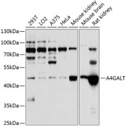 Western blot analysis of extracts of various cell lines, using A4GALT antibody (abx123708) at 1/1000 dilution.