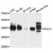Western blot analysis of extracts of various cell lines, using HLA-C antibody (abx123721) at 1/1000 dilution.