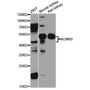Western blot analysis of extracts of various cell lines, using KCNK9 antibody (abx123727) at 1/1000 dilution.