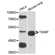 Western blot analysis of extracts of various cell lines, using TXNIP antibody (abx123744) at 1:3000 dilution.