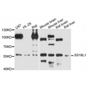Western blot analysis of extracts of various cell lines, using SS18L1 antibody (abx123750) at 1/1000 dilution.