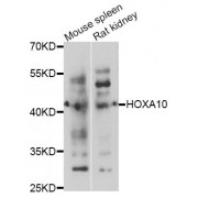 Western blot analysis of extracts of various cell lines, using HOXA10 antibody (abx123761) at 1/1000 dilution.
