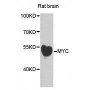Western blot analysis of extracts of rat brain, using MYC antibody (abx123800) at 1/500 dilution.