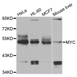 V-Myc Myelocytomatosis Viral Oncogene Homolog (MYC) Antibody