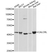 Western blot analysis of extracts of various cell lines, using CALCRL antibody (abx123818) at 1/1000 dilution.