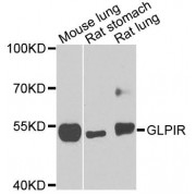 Western blot analysis of extracts of various cell lines, using GLP1R antibody (abx123823) at 1/1000 dilution.