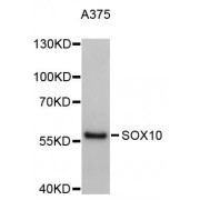 Western blot analysis of extracts of A-375 cells, using SOX10 antibody (abx123828).