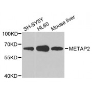 Western blot analysis of extracts of various cell lines, using METAP2 antibody (abx123839) at 1/1000 dilution.