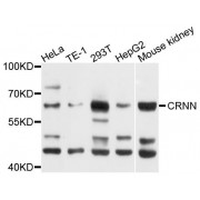 Western blot analysis of extracts of various cell lines, using CRNN antibody (abx123857) at 1/1000 dilution.
