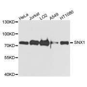 Western blot analysis of extracts of various cell lines, using SNX1 antibody (abx123882) at 1/1000 dilution.
