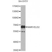 Immunohistochemistry of paraffin-embedded mouse stomach using MARVELD2 antibody (abx123920) (40x lens).
