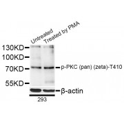 Western blot analysis of extracts of 293 cells, using Phospho-PKC (pan) (zeta)-T410 antibody (abx123949) at 1/1000 dilution. 293 cells were treated by PMA/TPA (200nM) for 30 minutes after serum-starvation overnight.