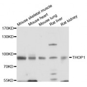 Western blot analysis of extracts of various cell lines, using THOP1 antibody (abx124019) at 1/1000 dilution.