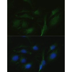 Transient Receptor Potential Cation Channel Subfamily V Member 1 (TRPV1) Antibody