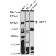 Western blot analysis of extracts of various cell lines, using TRPV1 antibody (1/1000 dilution).