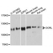 Western blot analysis of extracts of various cell lines, using OCRL antibody (abx124110) at 1/1000 dilution.