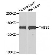Western blot analysis of extracts of various cell lines, using THBS2 antibody (abx124173) at 1/1000 dilution.