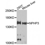 Western blot analysis of extracts of various cell lines, using NPHP3 antibody (abx124203) at 1/1000 dilution.