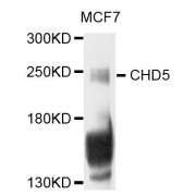 Western blot analysis of extracts of MCF-7 cells, using CHD5 antibody (abx124237) at 1/1000 dilution.