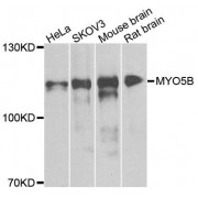 Western blot analysis of extracts of various cell lines, using MYO5B antibody (abx124250) at 1/1000 dilution.