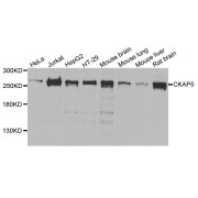 Western blot analysis of extracts of various cell lines, using CKAP5 antibody (abx124260) at 1/1000 dilution.