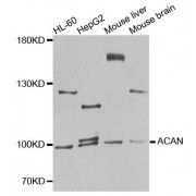 Western blot analysis of extracts of various cell lines, using ACAN antibody (abx124269) at 1/1000 dilution.
