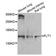 Western blot analysis of extracts of various cell lines, using FLT1 antibody (abx124272) at 1/1000 dilution.
