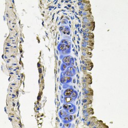 Vascular Endothelial Growth Factor Receptor 1 (FLT1) Antibody
