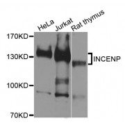Western blot analysis of extracts of various cell lines, using INCENP antibody (abx124282) at 1/1000 dilution.