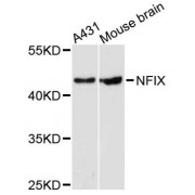 Western blot analysis of extracts of various cell lines, using NFIX antibody (abx124360) at 1:3000 dilution.