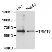 Western blot analysis of extracts of various cell lines, using TRMT6 antibody (abx124651) at 1:3000 dilution.