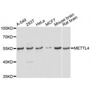 Western blot analysis of extracts of various cell lines, using METTL4 antibody (abx124765) at 1/2000 dilution.